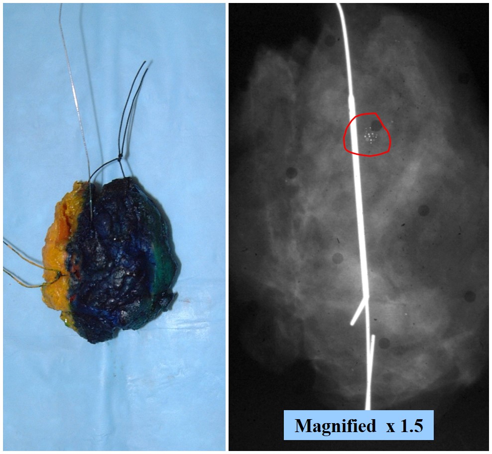 3-5_radiology_calcs-2.jpg