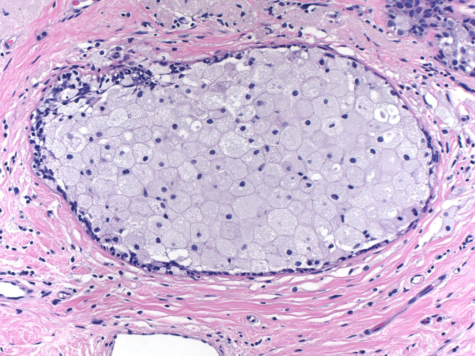 7-3_Histiocytes_20_x_B.jpg