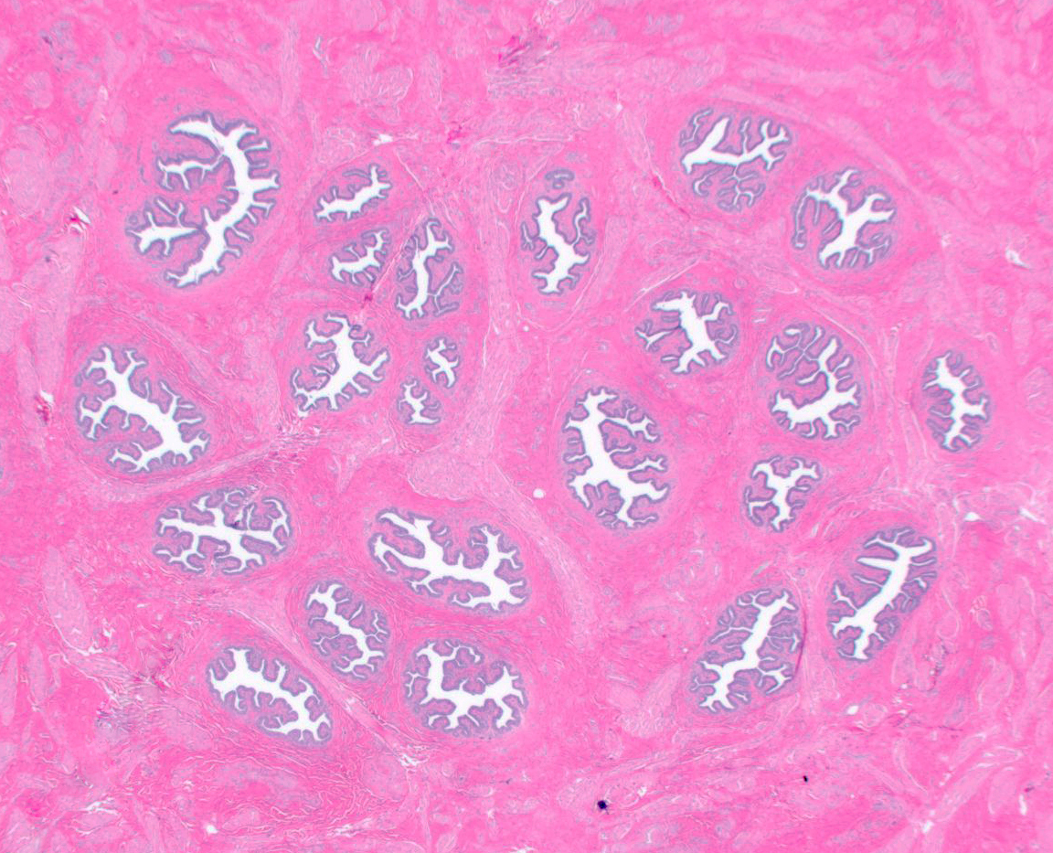 1-4_NA_lactiferous_sinuses_6.30.14.jpeg