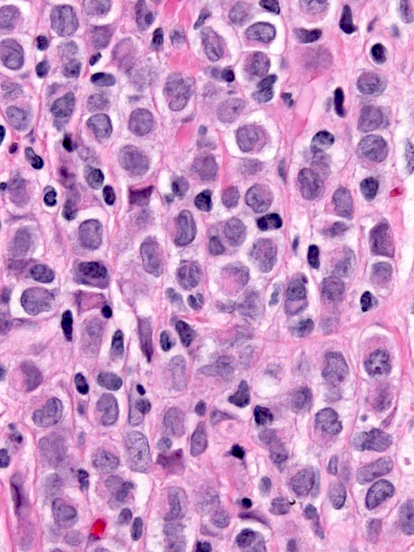 11-4_Cells_3_-_closeup.jpg