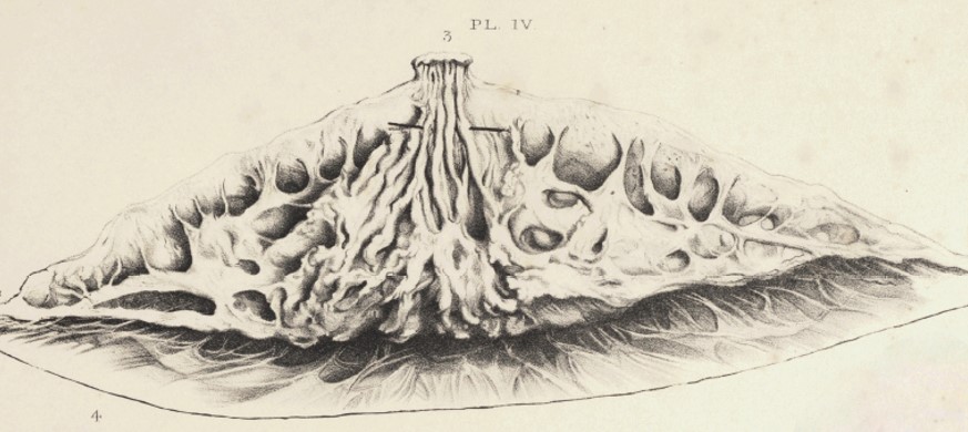 1-20_NA_fibrous-tissue_7.29.14.jpg