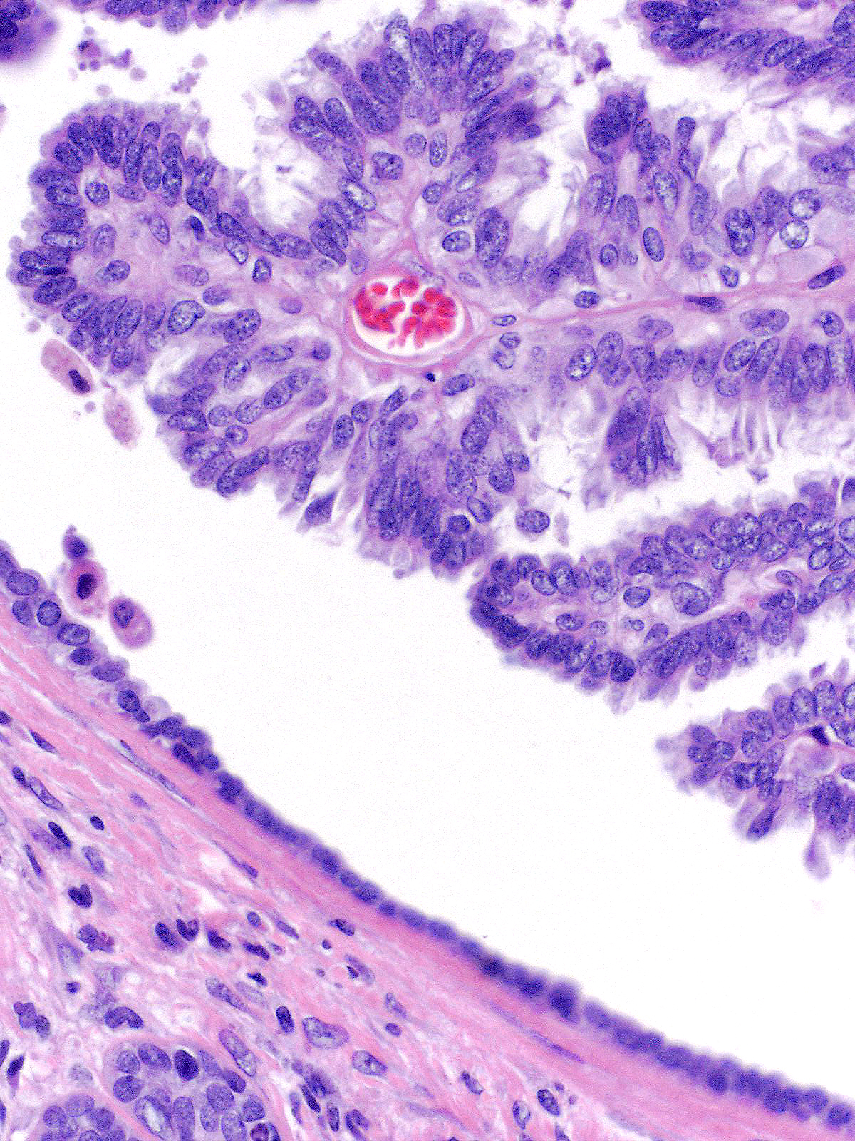 14-6_Epithelium-2.jpg