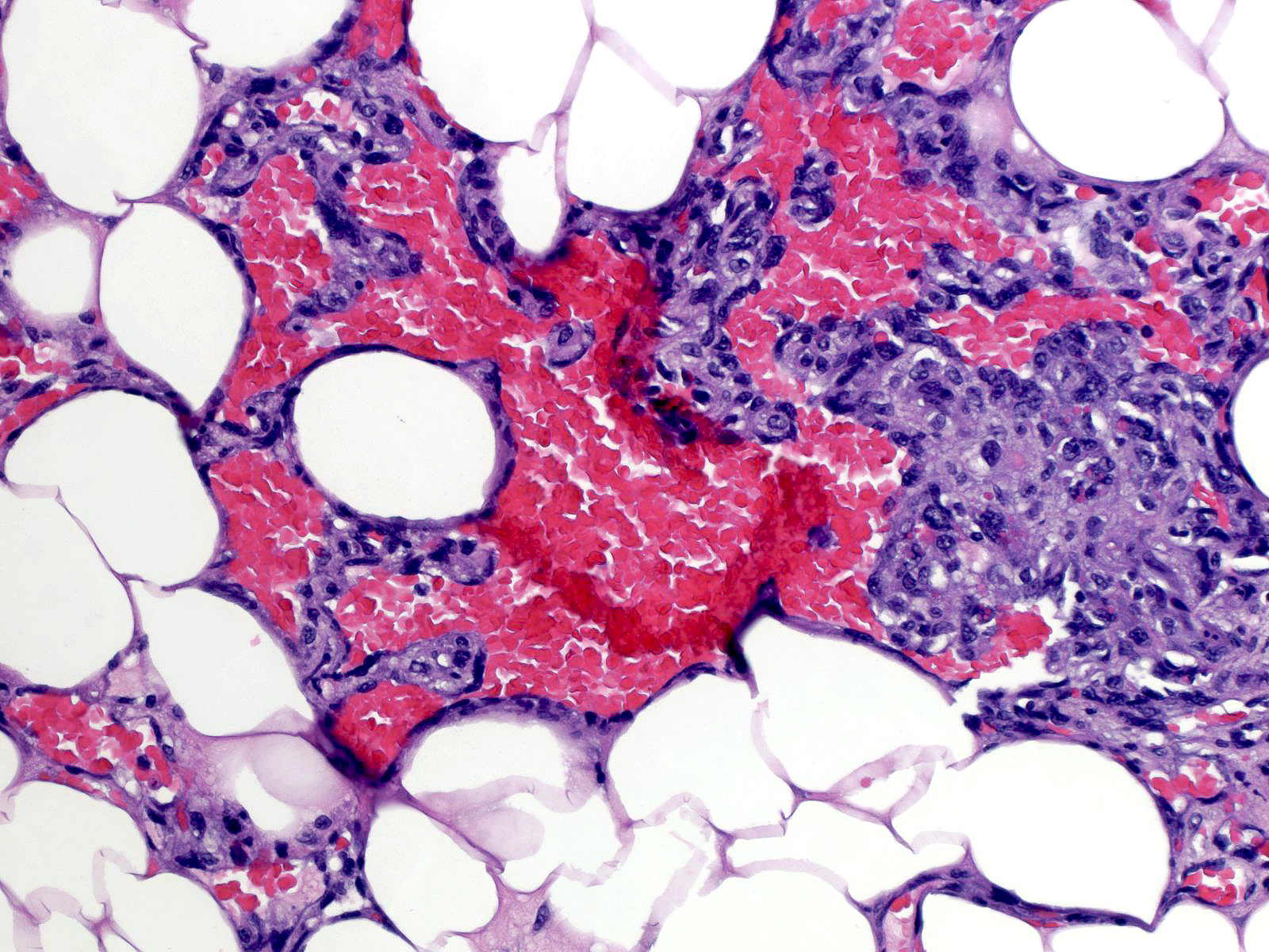 22-5_Micropapillae.jpg