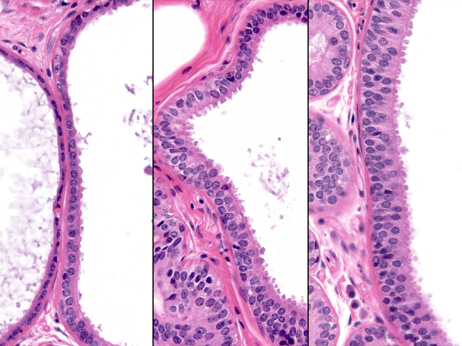 20-3_Continuum_2_Composite_A.jpg