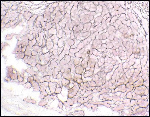 1-10-4_benign_liver_with_reticulin_stain.N12-4918.jpg